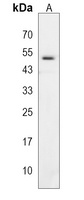 KRT37 Rabbit Polyclonal Antibody