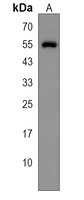 POLR3D Rabbit Polyclonal Antibody