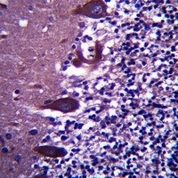 Anti-TLE6 Antibody