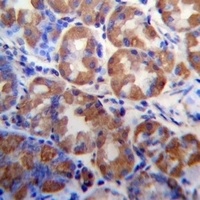 Anti-WDR89 Antibody