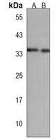 TAF8 Rabbit Polyclonal Antibody
