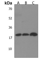 DHFRL1 Antibody