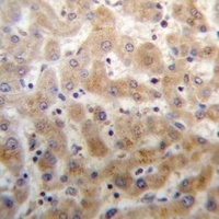 Anti-DHFRL1 Antibody