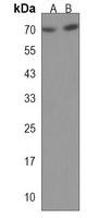 CCDC120 Rabbit Polyclonal Antibody