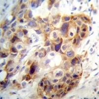 Anti-PI15 Antibody