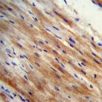 Anti-Apolipoprotein O Antibody