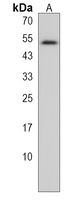 TASP1 Rabbit Polyclonal Antibody