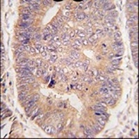 Anti-TASP1 Antibody