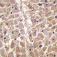 Anti-TRIM11 Antibody