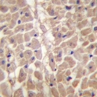 Anti-TRIM11 Antibody