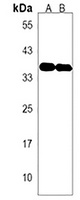 OR2A1 Rabbit Polyclonal Antibody