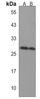CCDC134 Antibody
