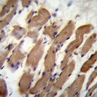 Anti-PALMD Antibody