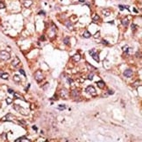 Anti-BIK Antibody