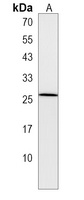 LHFPL1 Rabbit Polyclonal Antibody