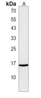 TMEM52B Antibody