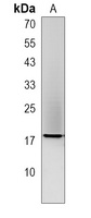 GAGE2B Rabbit Polyclonal Antibody