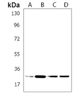 SSR2 Antibody