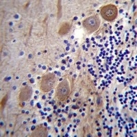 Anti-SSR2 Antibody