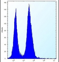 Anti-SSR2 Antibody