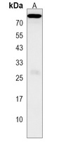WBSCR17 Rabbit Polyclonal Antibody