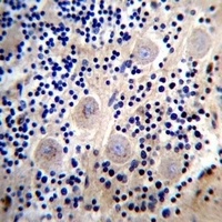 Anti-REPS2 Antibody