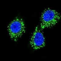 Anti-MPP3 Antibody
