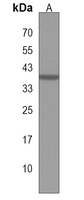 NIT1 Rabbit Polyclonal Antibody