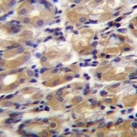 Anti-TOR1B Antibody