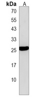 PIGH Rabbit Polyclonal Antibody