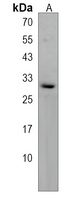PROSC Antibody