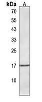 Hemoglobin θ Antibody