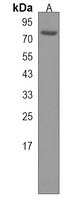 HIPK4 Rabbit Polyclonal Antibody