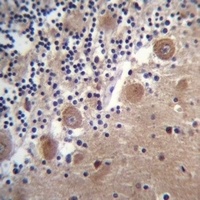 SCHIP1 Antibody
