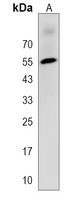 CHST8 Rabbit Polyclonal Antibody