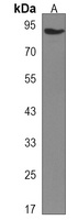RBM28 Rabbit Polyclonal Antibody