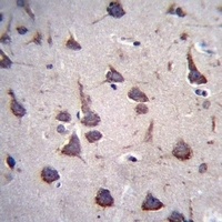 Fukutin Rabbit Polyclonal Antibody