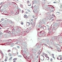 Anti-TPM4 Antibody