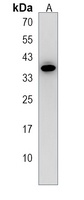 BTG3 Rabbit Polyclonal Antibody