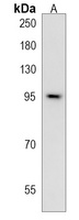 CTAGE5 Rabbit Polyclonal Antibody