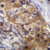 CTAGE5 Rabbit Polyclonal Antibody