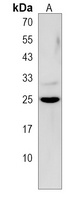 GSTM5 Antibody