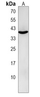 P2Y5 Rabbit Polyclonal Antibody