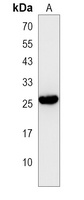 LRRN4CL Antibody