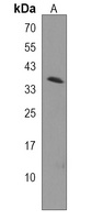 SLC38A8 Antibody
