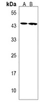 ACSM6 Rabbit Polyclonal Antibody