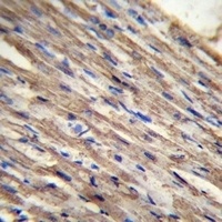 ACSM6 Rabbit Polyclonal Antibody