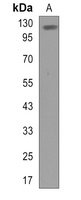 FBXO41 Antibody