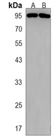 ARHGAP27 Antibody
