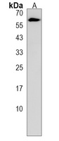 ZNF835 Rabbit Polyclonal Antibody
